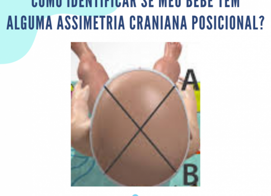 Como identificar se meu bebê tem alguma assimetria craniana posicional
